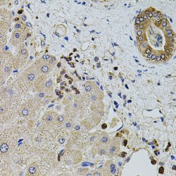Kinectin 1 (KTN1) Antibody