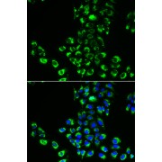 Immunofluorescence analysis of A549 cells using EIF5B Antibody