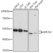 abx004521