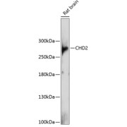 Western blot analysis of extracts of Rat brain using CHD2 Antibody (1/1000 dilution).