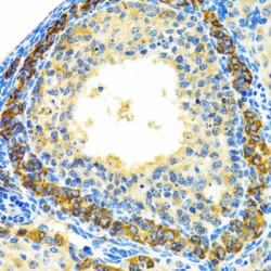 Mitochondrial Ribosomal Protein L28 (MRPL28) Antibody