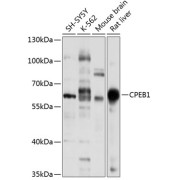 Western blot analysis of extracts of various cell lines using CPEB1 Antibody (1/1000 dilution).