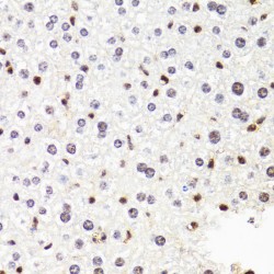 DNA-Directed RNA Polymerase II Subunit RPB2 (POLR2B) Antibody