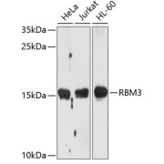 abx004547