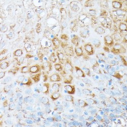 Ribosomal Protein L7 (RPL7) Antibody