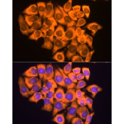 Ribosomal Protein L17 (RPL17) Antibody