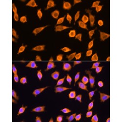 Ribosomal Protein L17 (RPL17) Antibody