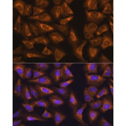 Ribosomal Protein L17 (RPL17) Antibody