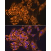 Immunofluorescence analysis of C6 cells using RPL17 Antibody (1/100 dilution). Blue: DAPI for nuclear staining.
