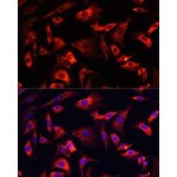 Fragile X Mental Retardation, Autosomal Homolog 1 (FXR1) Antibody