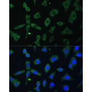 Immunofluorescence analysis of L-929 cells using EIF3D Antibody (1/100 dilution). Blue: DAPI for nuclear staining.