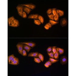 Serine-Threonine Kinase Receptor-Associated Protein (STRAP) Antibody
