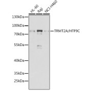 Western blot analysis of extracts of various cell lines using TRMT2A/HTF9C Antibody (1/1000 dilution).