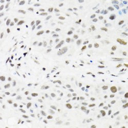 tRNA (uracil-5-)-Methyltransferase Homolog A (TRMT2A) Antibody