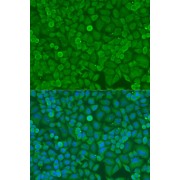 Immunofluorescence analysis of U2OS cells using DICER1 Antibody (1/100 dilution). Blue: DAPI for nuclear staining.