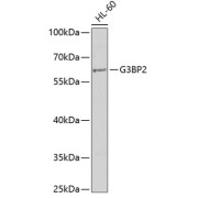 Western blot analysis of extracts of HL-60 cells using G3BP2 Antibody (1/1000 dilution).