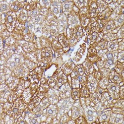 Vigilin (HDLBP) Antibody