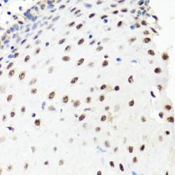 Pre-mRNA Processing Factor 8 (PRPF8) Antibody