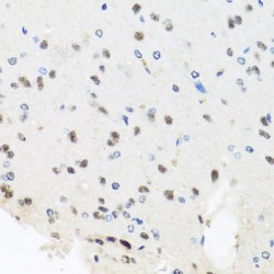 Pre-mRNA Processing Factor 8 (PRPF8) Antibody
