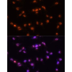 Pre-mRNA Processing Factor 8 (PRPF8) Antibody