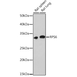 Ribosomal Protein S6 (RPS6) Antibody