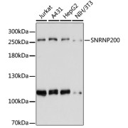 Western blot analysis of extracts of various cell lines using SNRNP200 Antibody (1/3000 dilution).