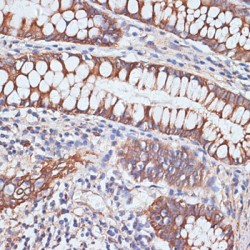 Polymeric Immunoglobulin Receptor (PIGR) Antibody