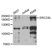 Western blot analysis of extracts of various cell lines using ERCC6L Antibody (1/1000 dilution).