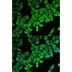 Death-Associated Protein 1 (DAP) Antibody