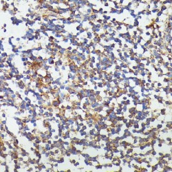 Granulocyte Colony-Stimulating Factor (CSF3) Antibody
