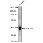 Western blot analysis of extracts of OVCAR3 cells using Mesothelin Antibody (1/1000 dilution).