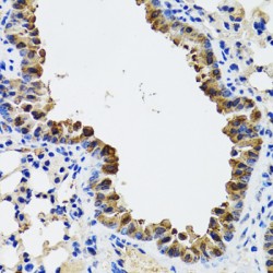 S-Formylglutathione Hydrolase (ESD) Antibody