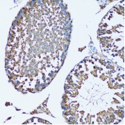 Immunohistochemistry of paraffin-embedded Mouse testis using FDFT1 Antibody (1/100 dilution, 20x lens).