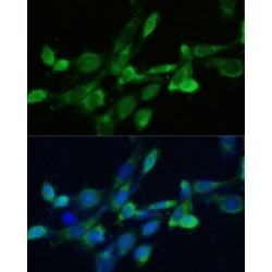 Farnesyl Diphosphate Farnesyltransferase 1 (FDFT1) Antibody