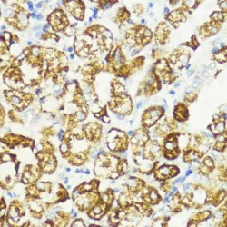 Proline-Rich AKT1 Substrate 1 (AKT1S1) Antibody