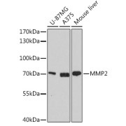 Western blot analysis of extracts of various cell lines using MMP2 Antibody (1/1000 dilution).