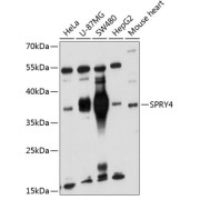 Western blot analysis of extracts of various cell lines using SPRY4 Antibody (1/1000 dilution).