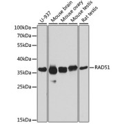 Western blot analysis of extracts of various cell lines using RAD51 Antibody (1/1000 dilution).