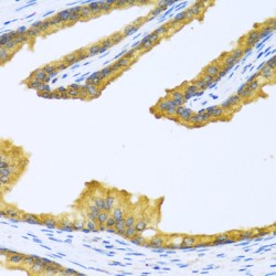 Biotinidase (BTD) Antibody