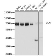 Western blot analysis of extracts of various cell lines using DLAT Antibody (1/1000 dilution).