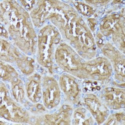 Dihydrolipoyl Transacetylase (DLAT) Antibody