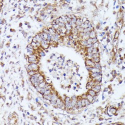 Dihydrolipoyl Transacetylase (DLAT) Antibody