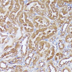 Dihydrolipoyl Transacetylase (DLAT) Antibody