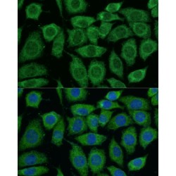 Dihydrolipoyl Transacetylase (DLAT) Antibody