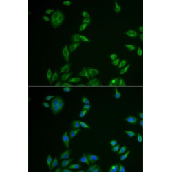 Melan-A (MLANA) Antibody