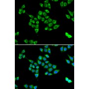 Immunofluorescence analysis of U2OS cells using PC Antibody