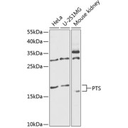 Western blot analysis of extracts of various cell lines using PTS Antibody (1/1000 dilution).