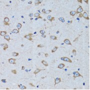 Immunohistochemistry of paraffin-embedded Rat brain using RARS Antibody (1/100 dilution, 40x lens).