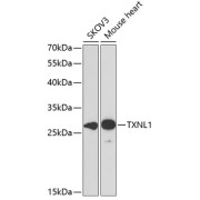 Western blot analysis of extracts of various cell lines using TXNL1 Antibody (1/1000 dilution).