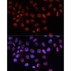 Regulator Of Chromosome Condensation 1 (RCC1) Antibody